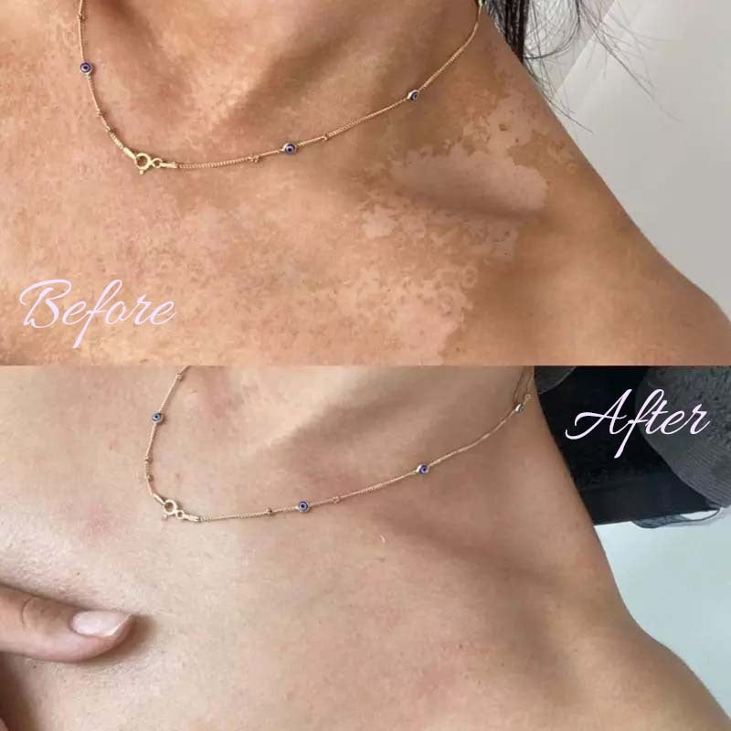 Monfrigo Silk Exfoliating Gloves